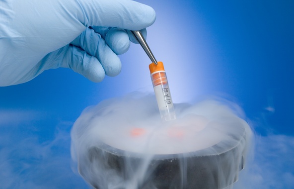 Sperm Freezing